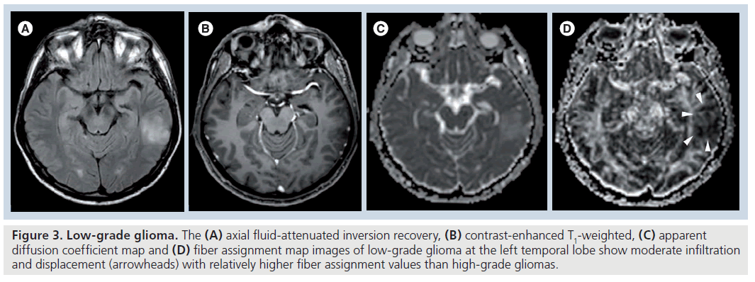 imaging-in-medicine-Low-grade