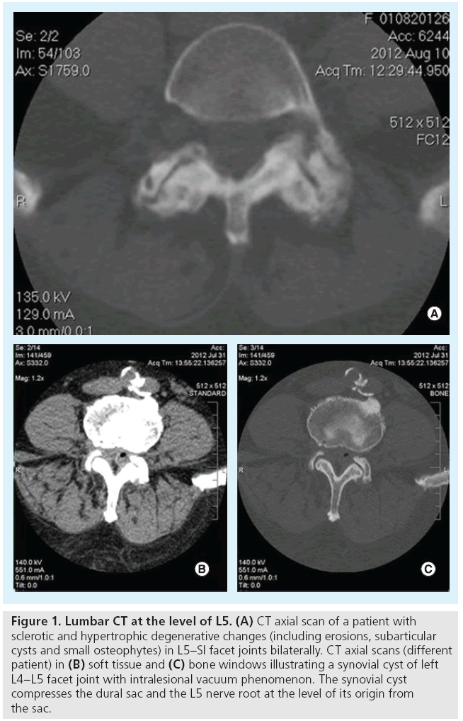 imaging-in-medicine-Lumbar-CT