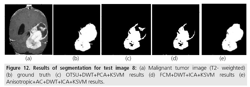 imaging-in-medicine-Malignant