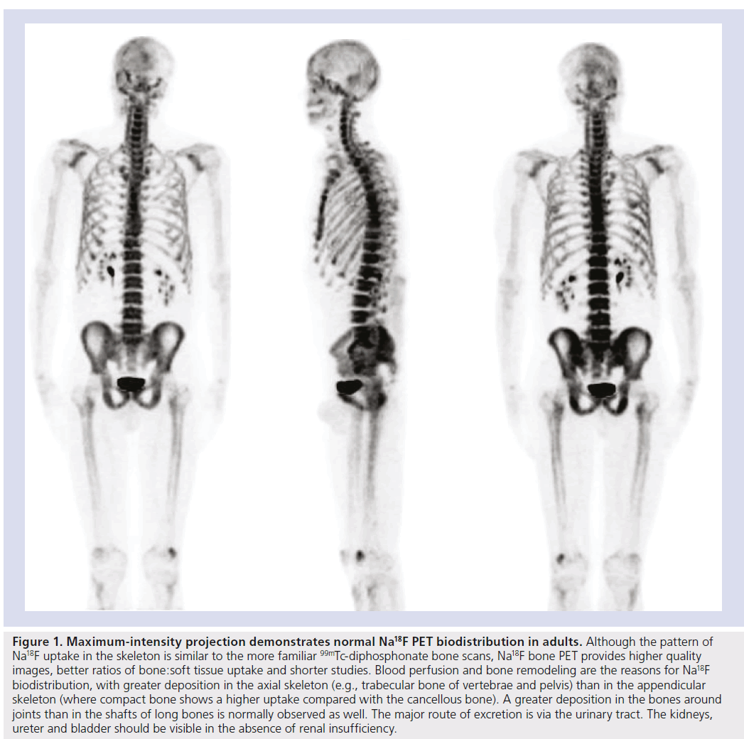 imaging-in-medicine-Maximum-intensity
