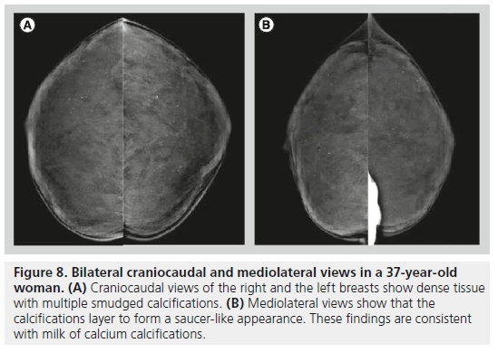 imaging-in-medicine-Mediolateral-views