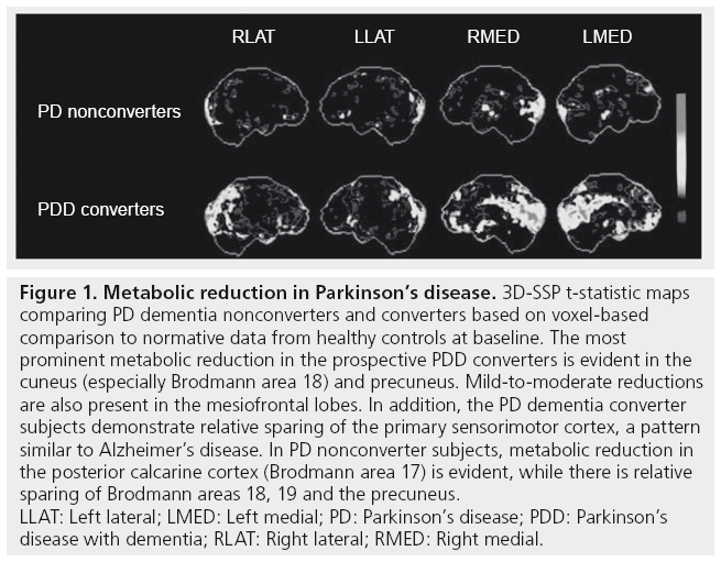 imaging-in-medicine-Metabolic-reduction