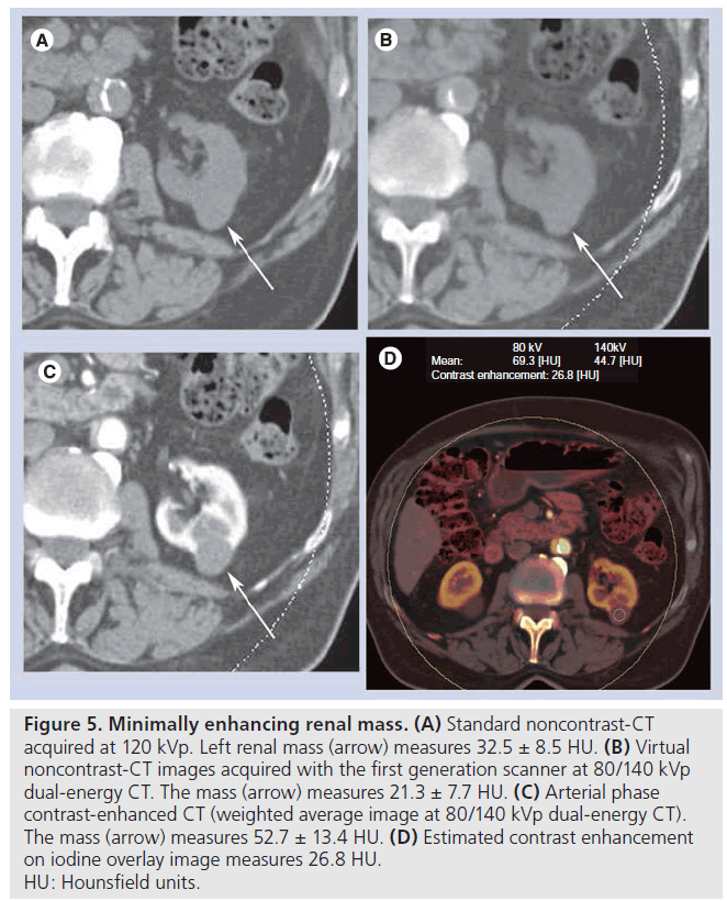 imaging-in-medicine-Minimally-enhancing