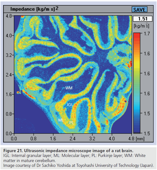 imaging-in-medicine-Molecular-layer