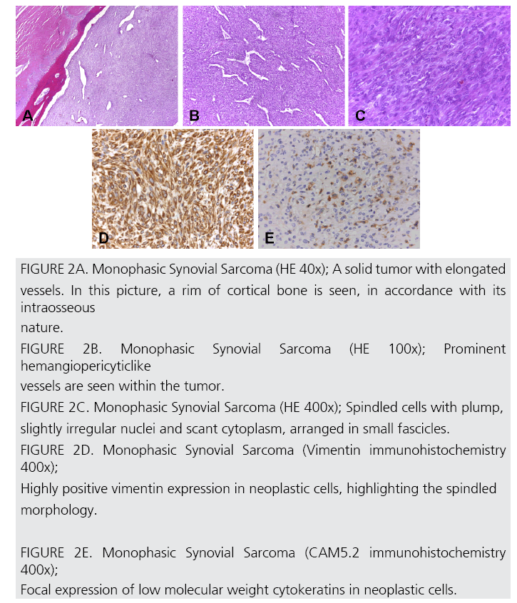 imaging-in-medicine-Monophasic-Synovial