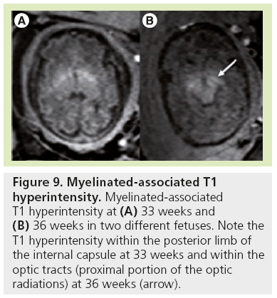 imaging-in-medicine-Myelinated-associated
