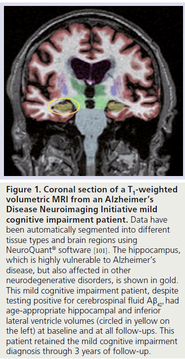 imaging-in-medicine-Neuroimaging-Initiative