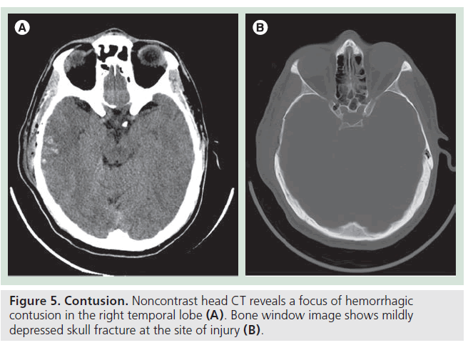 imaging-in-medicine-Noncontrast-head