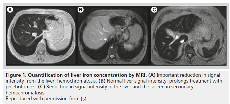imaging-in-medicine-Normal-liver