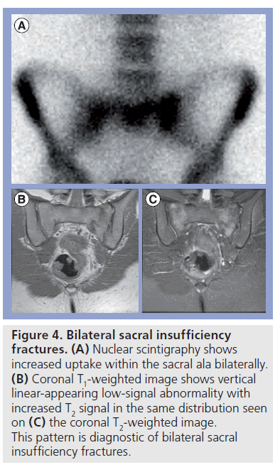 imaging-in-medicine-Nuclear-scintigraphy