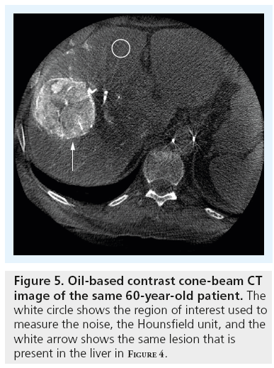 imaging-in-medicine-Oil-based