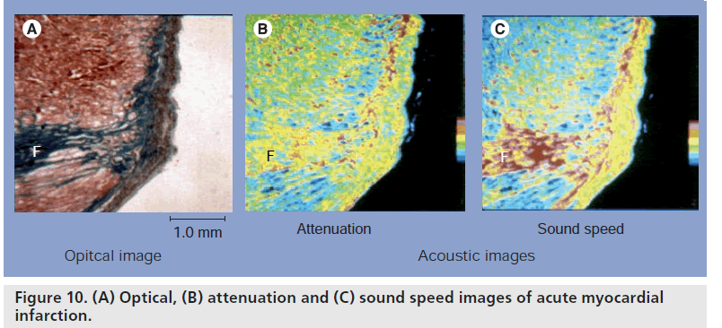 imaging-in-medicine-Optical-attenuation
