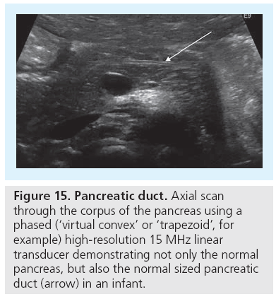 imaging-in-medicine-Pancreatic-duct