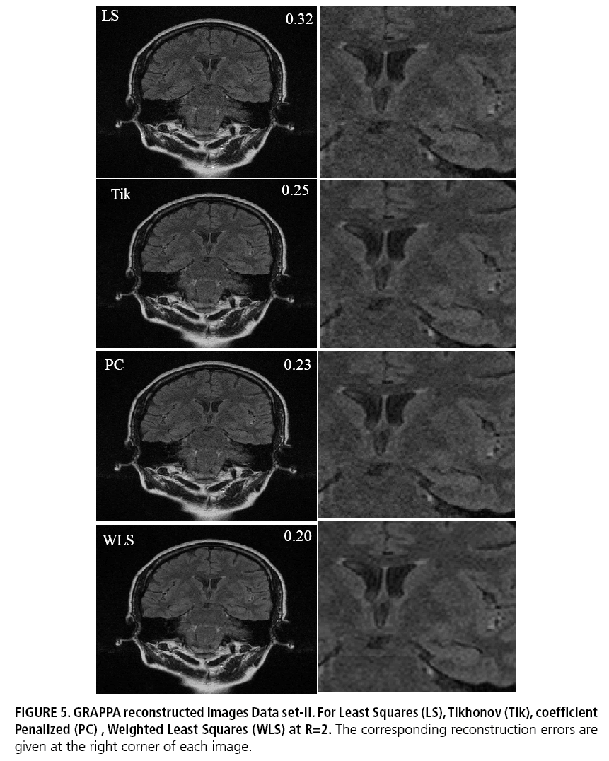 imaging-in-medicine-Penalized