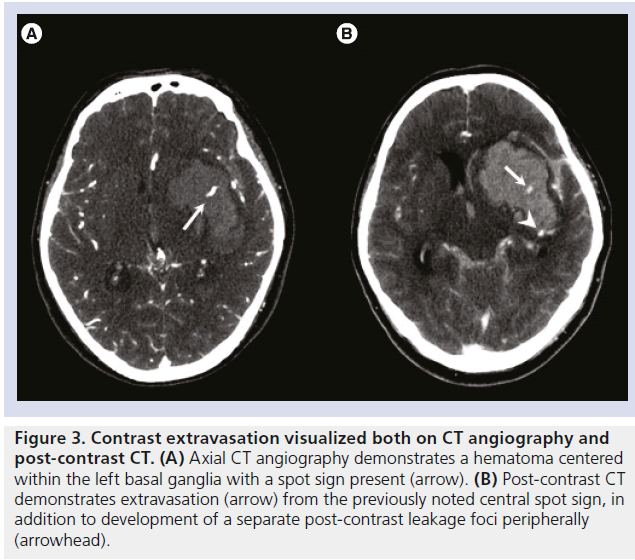 imaging-in-medicine-Post-contrast