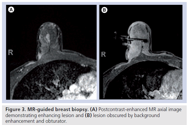 imaging-in-medicine-Postcontrast-enhanced