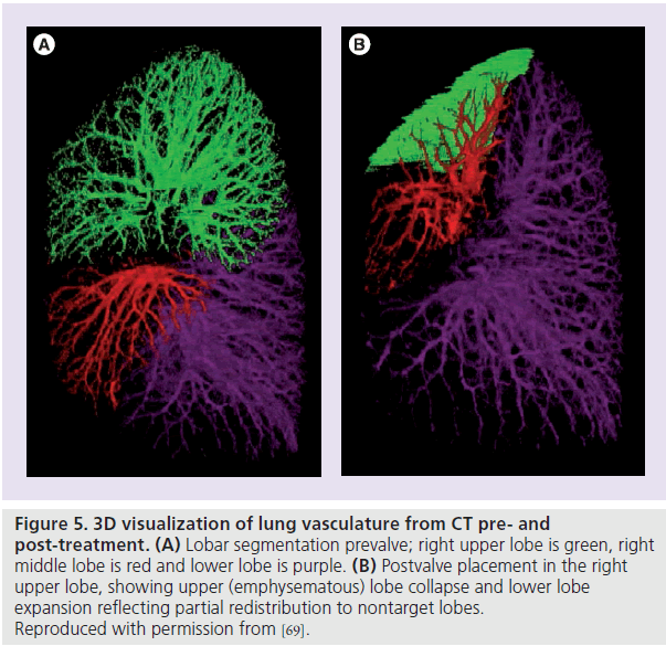 imaging-in-medicine-Postvalve-placement