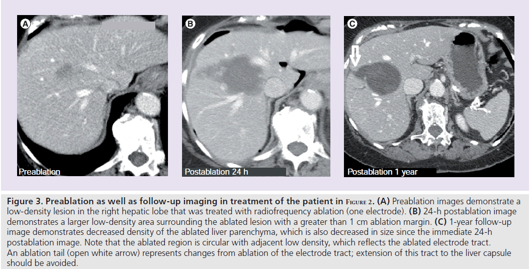 imaging-in-medicine-Preablation-images