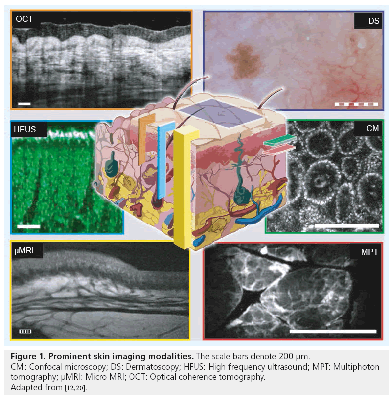 3d Optical Coherence Tomography For Clinical Diagnosis Of