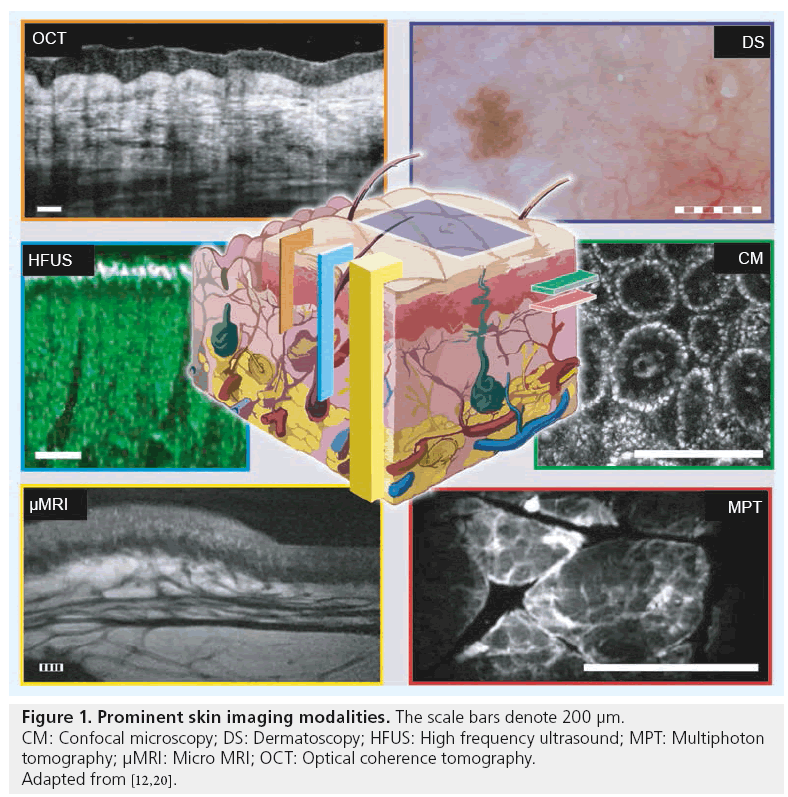 imaging-in-medicine-Prominent-skin