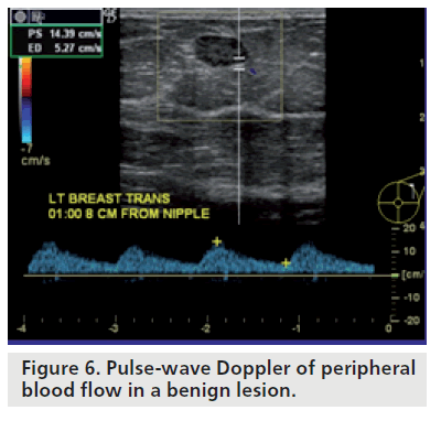 imaging-in-medicine-Pulse-wave