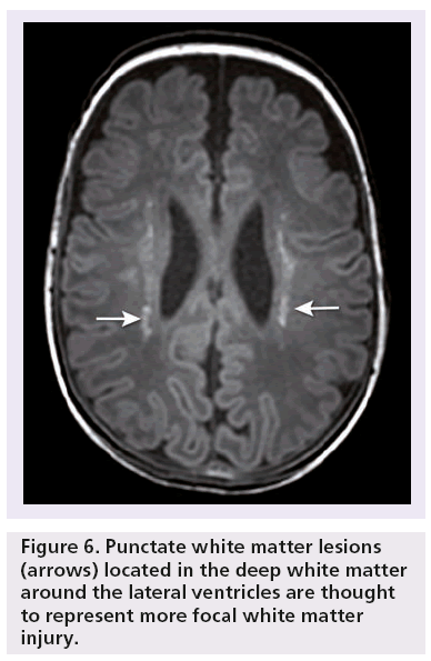 imaging-in-medicine-Punctate-white