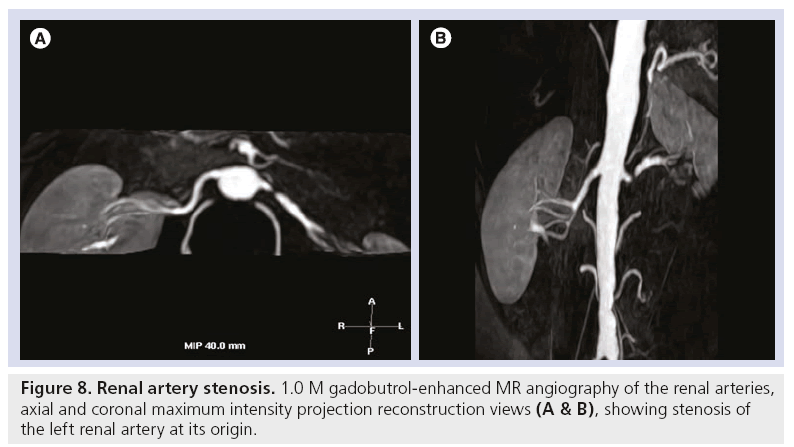 imaging-in-medicine-Renal-artery