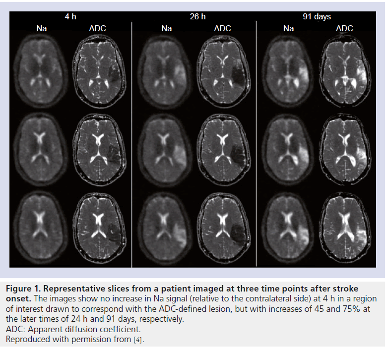 imaging-in-medicine-Representative-slices