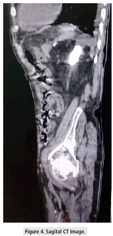 imaging-in-medicine-Sagital-CT