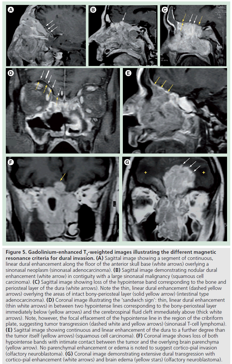 imaging-in-medicine-Sagittal-image