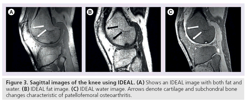 imaging-in-medicine-Sagittal-images