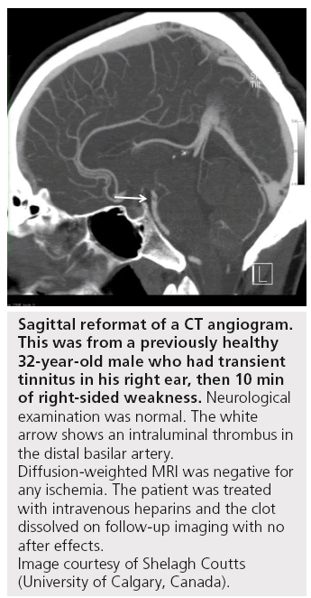imaging-in-medicine-Sagittal-reformat
