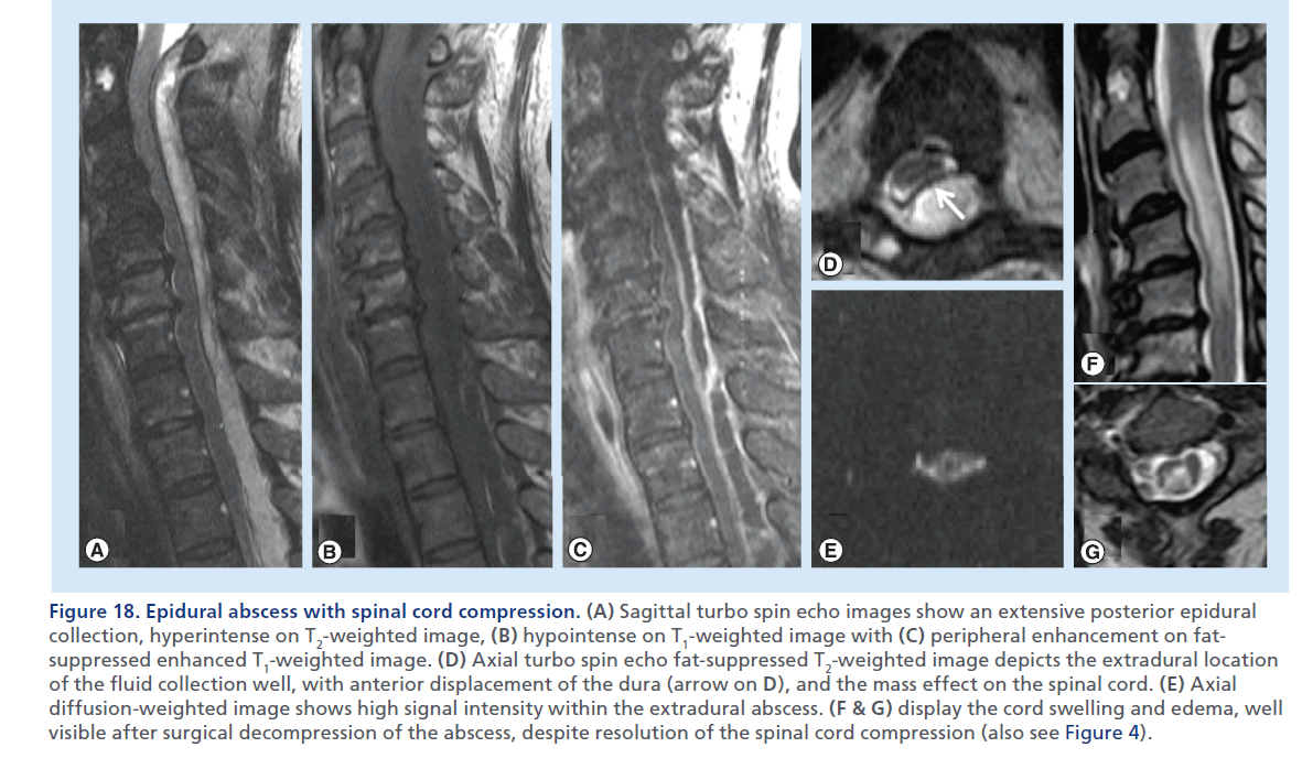 imaging-in-medicine-Sagittal–fat
