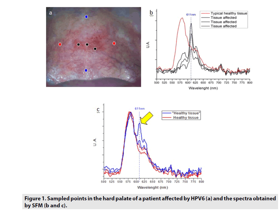 imaging-in-medicine-Sampled-points