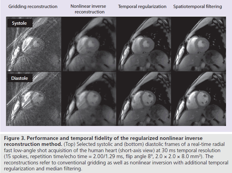 imaging-in-medicine-Selected-systolic