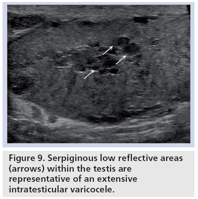 imaging-in-medicine-Serpiginous-low