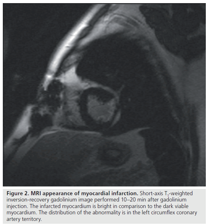 imaging-in-medicine-Short-axis