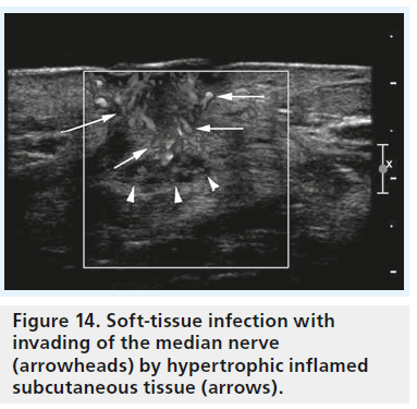 imaging-in-medicine-Soft-tissue