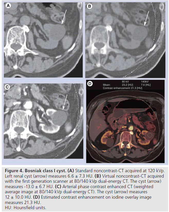 imaging-in-medicine-Standard-noncontrast