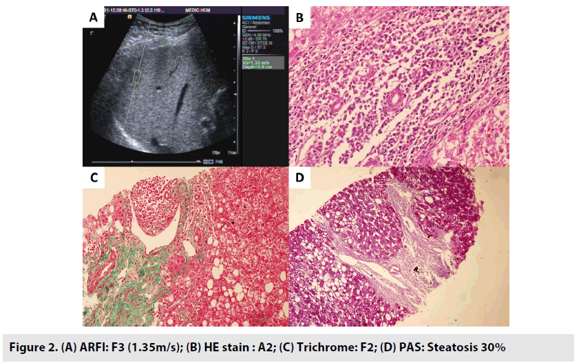 imaging-in-medicine-Steatosis