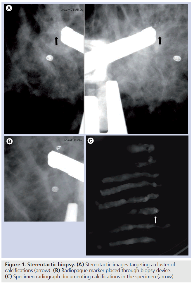 imaging-in-medicine-Stereotactic-images