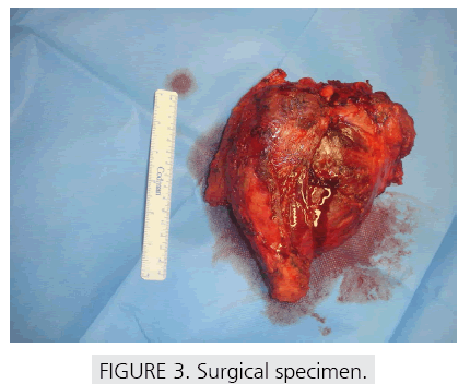 imaging-in-medicine-Surgical-specimen