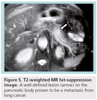 imaging-in-medicine-T2-weighted