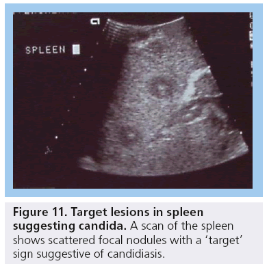 imaging-in-medicine-Target-lesions