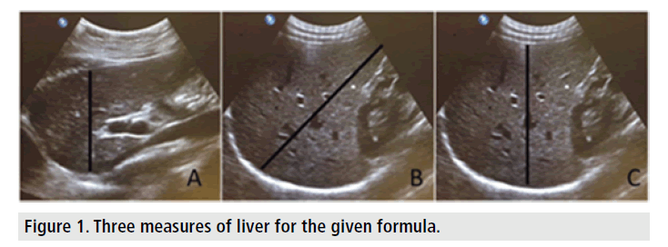 imaging-in-medicine-Three-measures