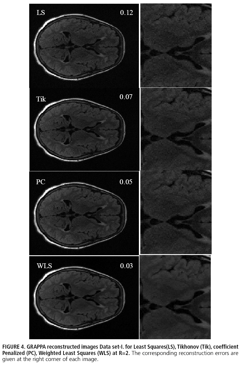 imaging-in-medicine-Tikhonov