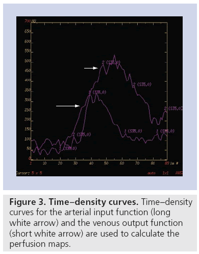 imaging-in-medicine-Time–density