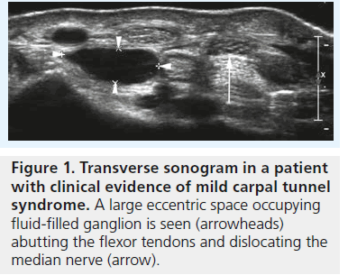 imaging-in-medicine-Transverse-sonogram