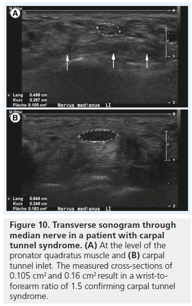 imaging-in-medicine-Transverse-sonogram