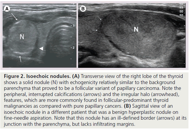 imaging-in-medicine-Transverse-view